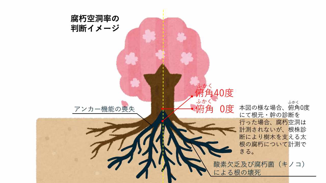 根株診断